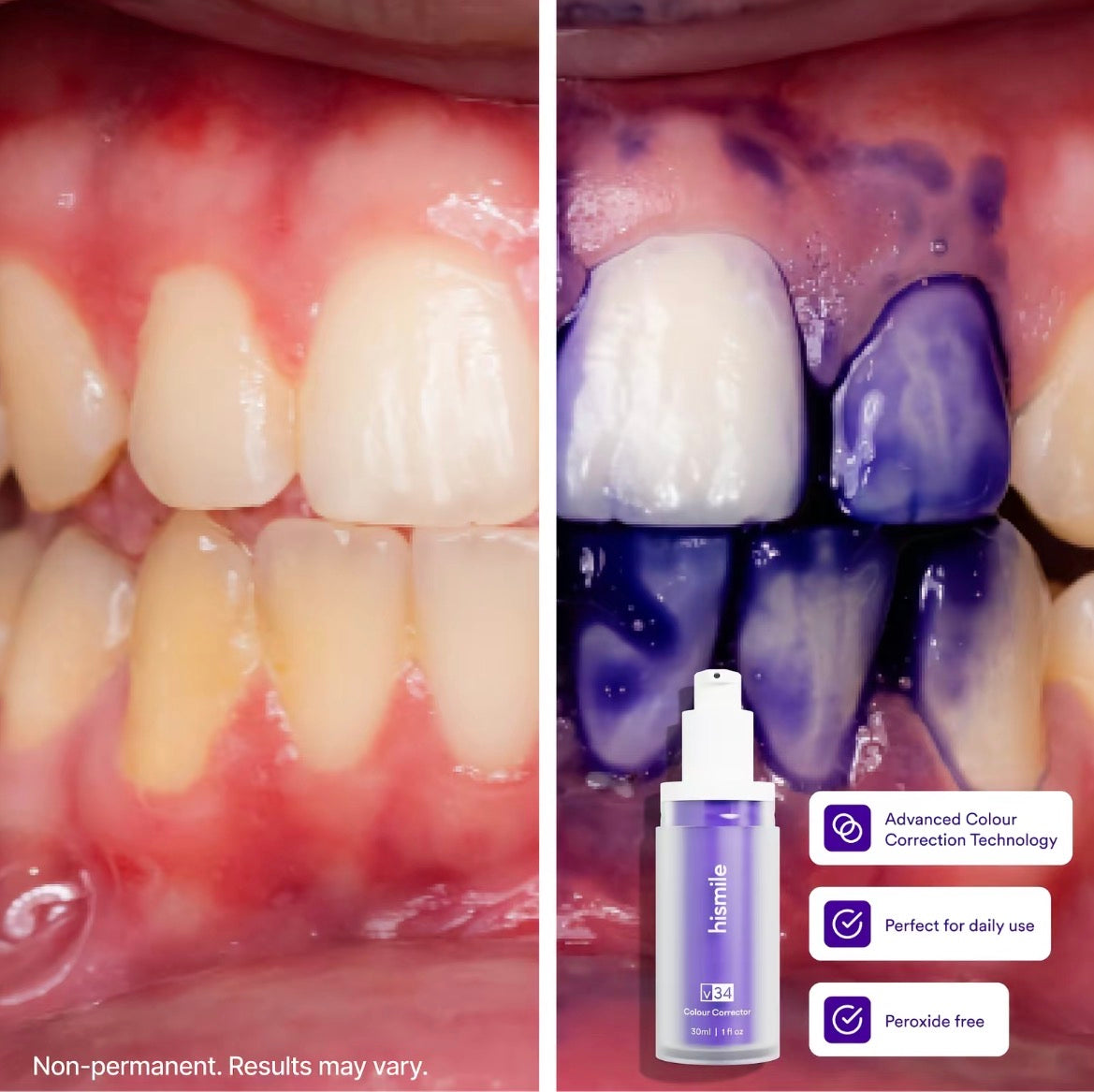 Natural whitening