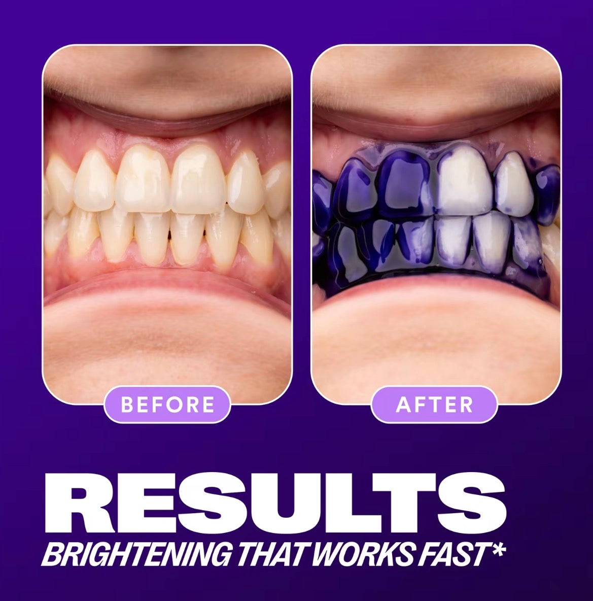 Natural whitening